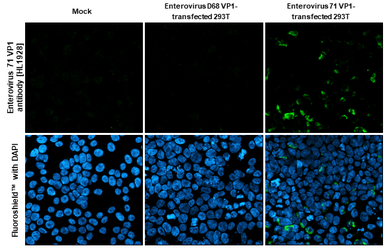 Anti-Enterovirus 71 VP1 antibody [HL1928] used in Immunocytochemistry/ Immunofluorescence (ICC/IF). GTX637687